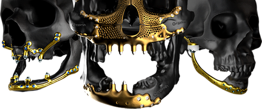 Renders 3D Cranios CPMH